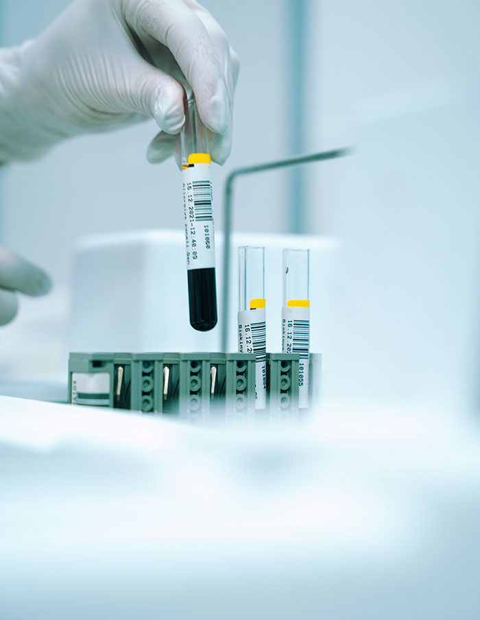 Bloodwork and Biomarkers